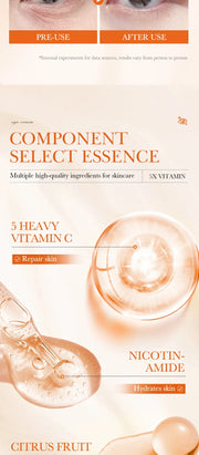 SADOER Vitamin C Eye Cream – Brighten & Reduce Dark Circles