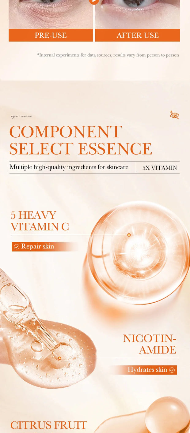 SADOER Vitamin C Eye Cream – Brighten & Reduce Dark Circles