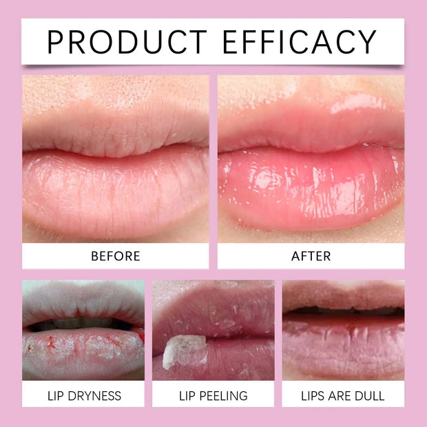 Pink Lip Essence – Moisturizing, Brightening & Line-Smoothing Lip Treatment | Korean Skincare Formula