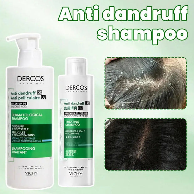 Dercos Anti-Dandruff Shampoo – Deep Cleanse, Repair & Soothing Care